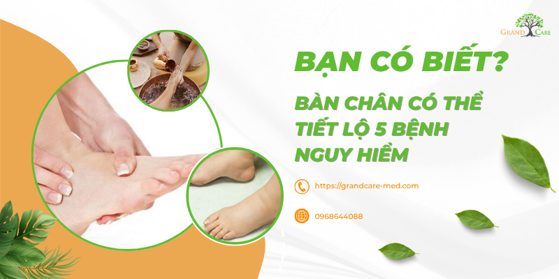 BẠN CÓ BIẾT? BÀN CHÂN CÓ THỂ TIẾT LỘ 5 BỆNH NGUY HIỂM