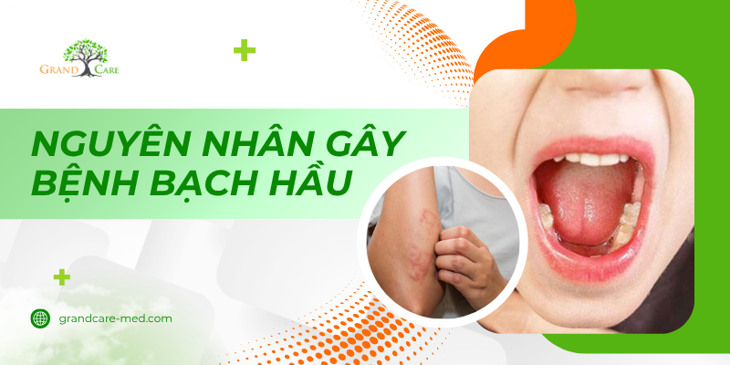 Nguyên nhân gây bệnh bạch hầu