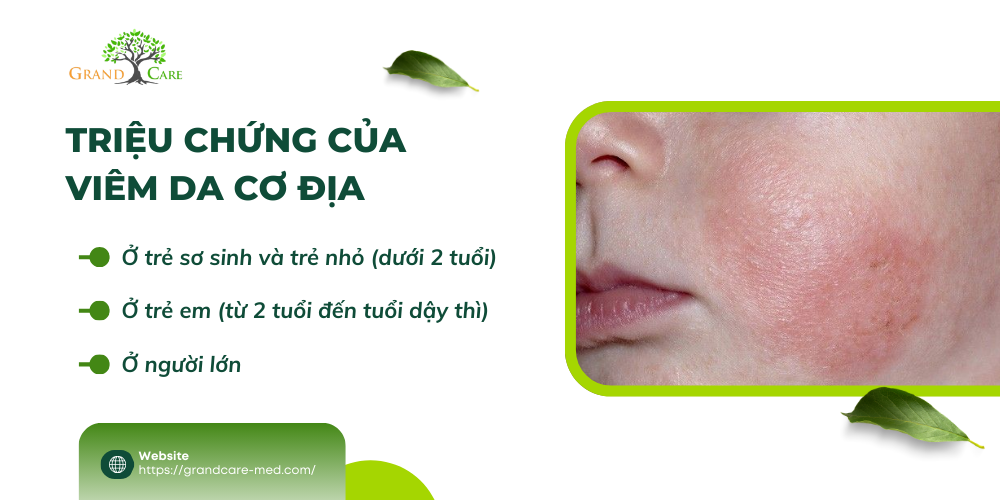 TRIỆU CHỨNG CỦA VIÊM DA CƠ ĐỊA
