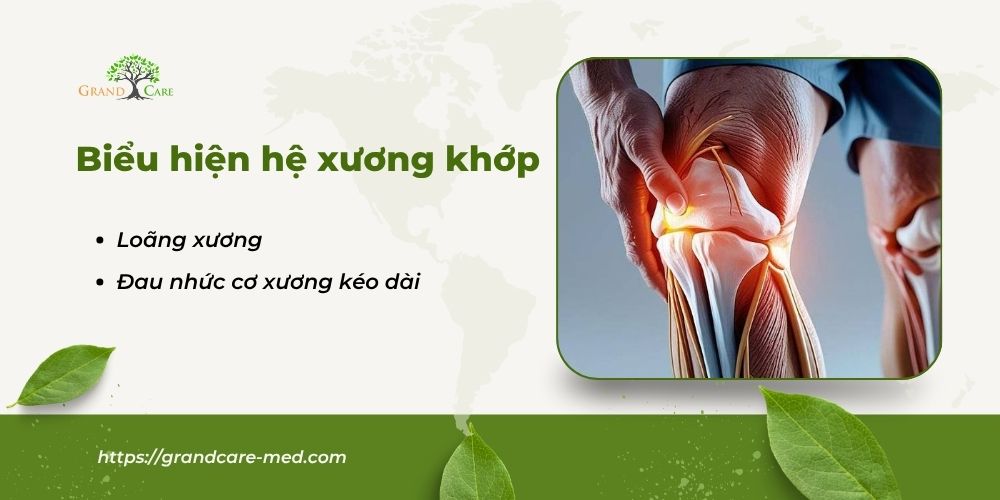 Biểu hiện hệ xương khớp